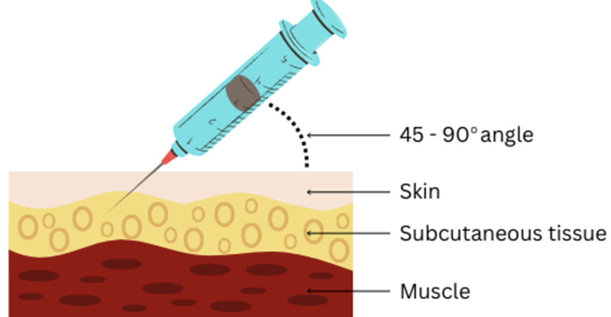 <p>45° or 90°.</p>