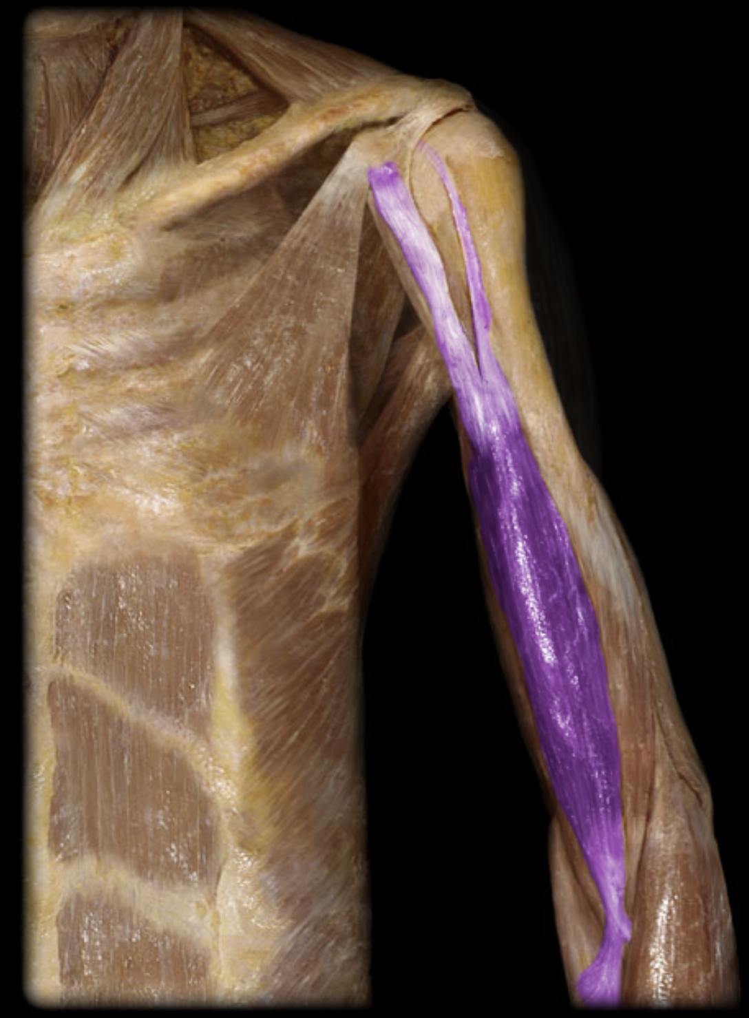 <p>Is this muscle in the anterior or posterior compartment of the brachium?</p>