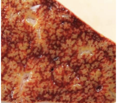 <p>What is this gross image showing?</p>