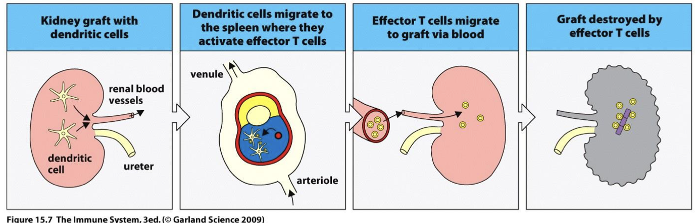 <p>Acute rejection is due to recipient alloreactive T cells attacking graft by allorecognition</p>