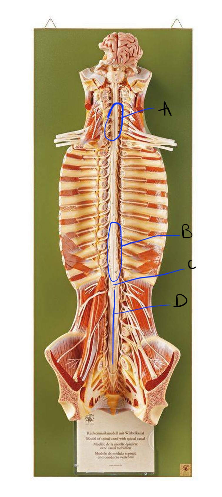 <p>B</p>