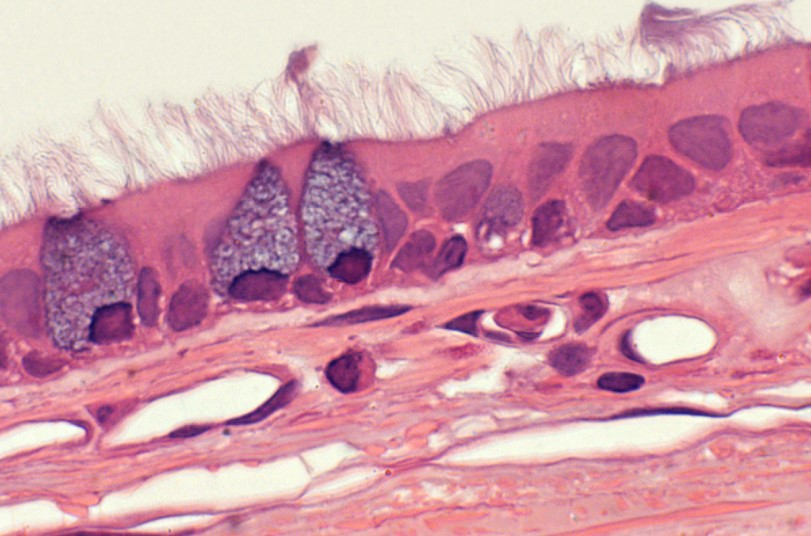 <p><strong>Tejido epitelial pseudoestratificado</strong></p>