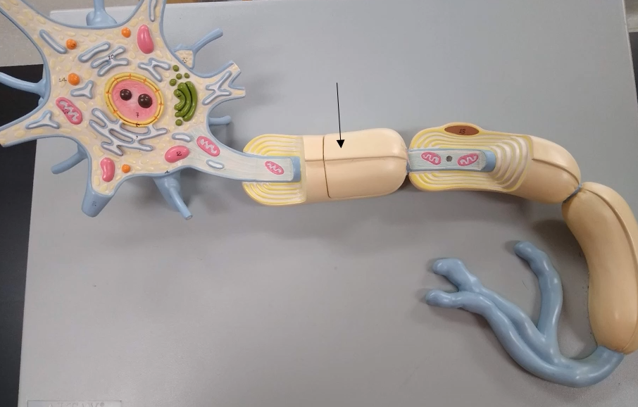 <p>What is the tan-ish part of the axon?</p>