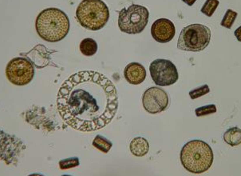 <p>What disease do Diatoms cause?</p>