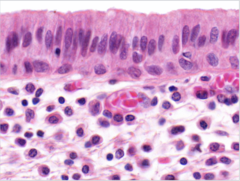 <p>Identify</p>
