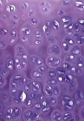 <p>What type of cartilage?</p>