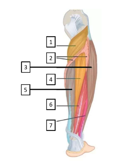 <p>Which muscle is identified by the number 4?</p>