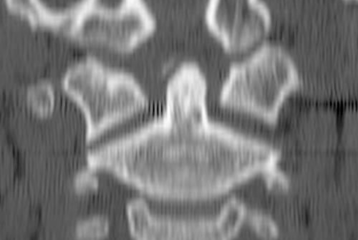 <p>What is the diagnosis?</p>