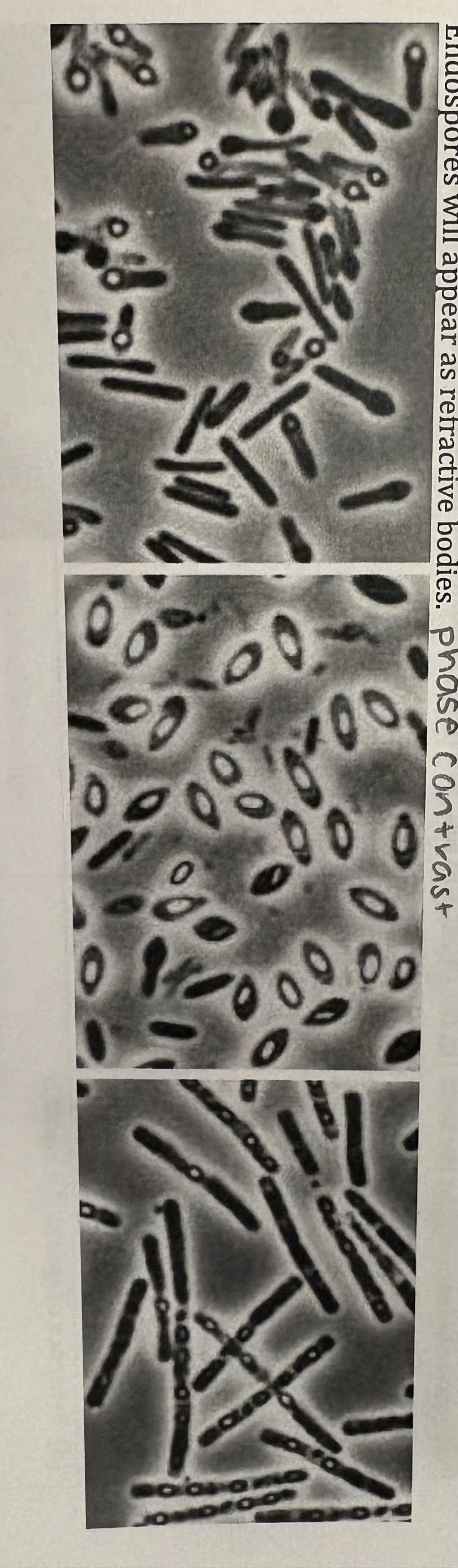 <p>Endospores </p>
