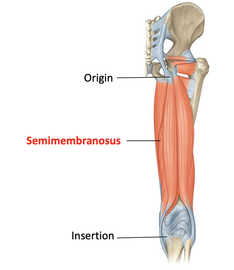 <p>Origin: superolateral impression on ischial tuberosity </p><p>Insertion: posterior surface of medial tibial condyle </p><p>Nerve supply: sciatic nerve - tibial divison </p><p>Nerve roots: L5, S1, S2</p>