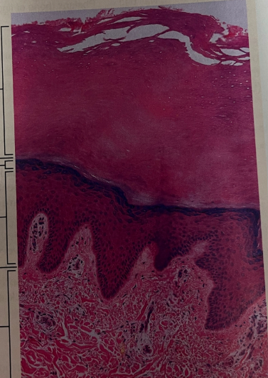 <p>what is the order of the epidermis layers from most superficial to deepest and what type of tissue is under the epidermis layer</p>