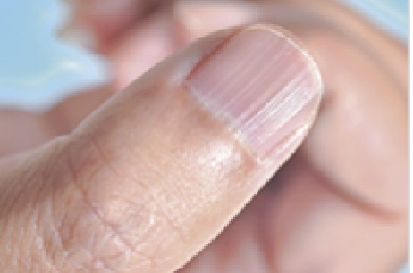 <p></p>