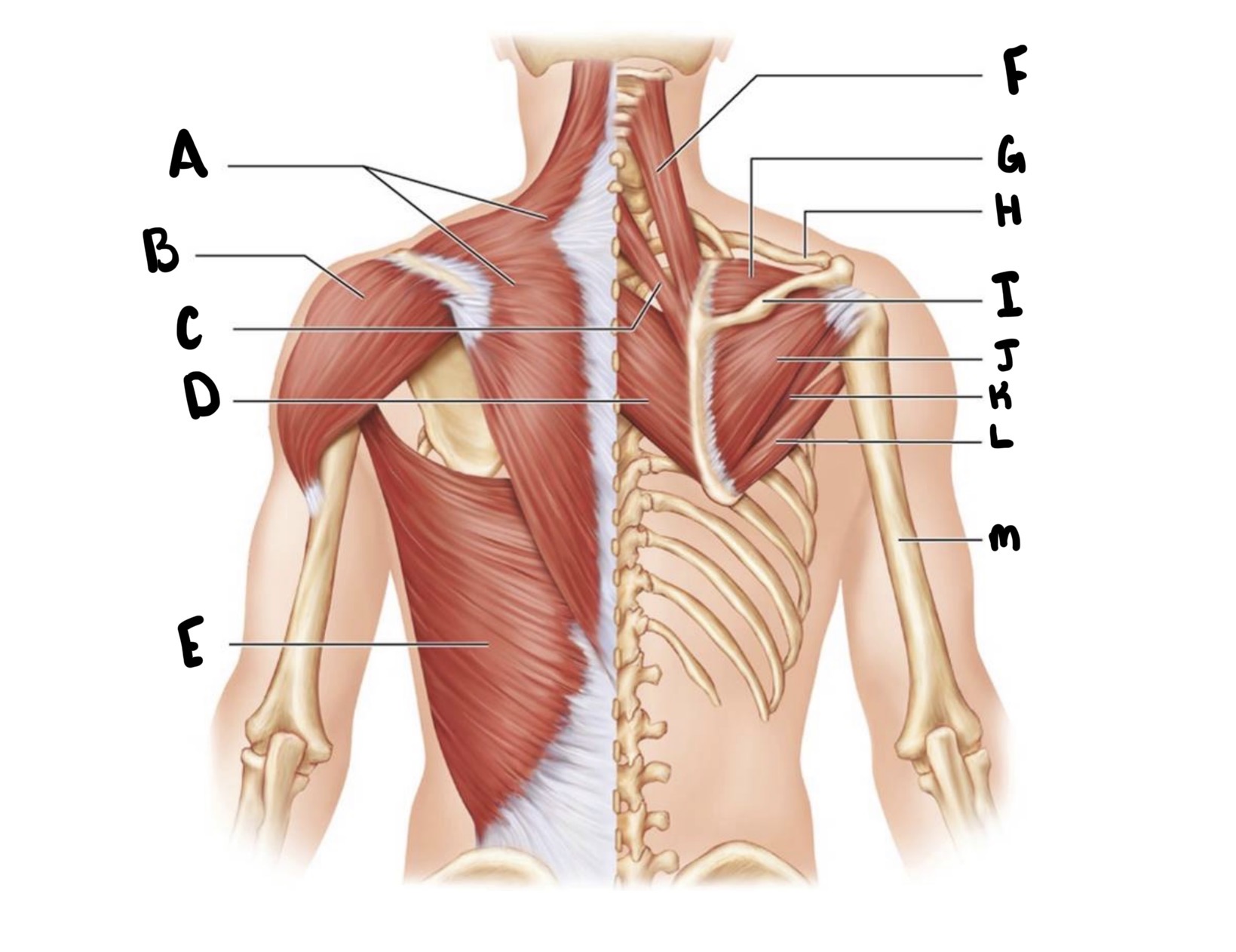 <p>A?</p>