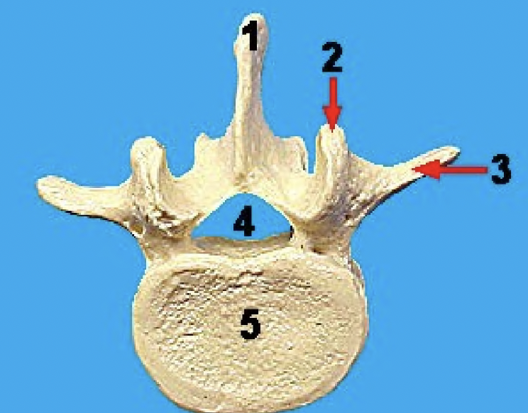 <p>what vertebra is this and what view</p>