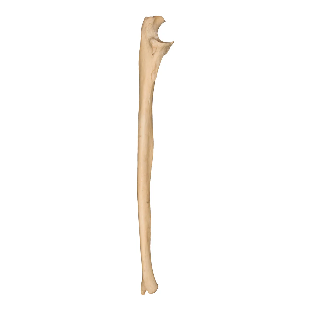 <p>Identify this bone</p>