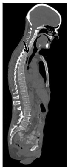 <p>Name of CT image?</p>