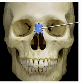 <p>What Structure is indicated? </p>