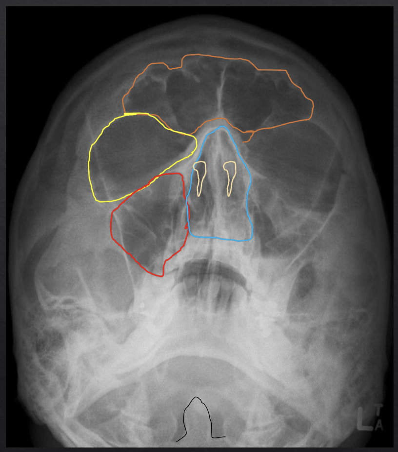 <p>what structure is circled in blue?</p>