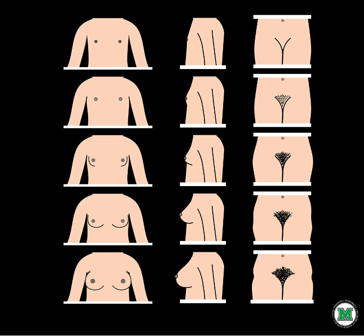 <p>1. prepubertal</p><p>2. breast buds</p><p>3. growth of breast and areola</p><p>4. seperation of nipple and areola from mound of breast aka "secondary mound"</p><p>5. areola rejoins breast (complete development)</p>