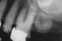 <ol start="50"><li><p>Identify the finding shown.</p></li></ol><p></p>