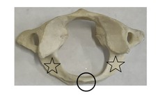 <p>what is marked? (not the star)</p>