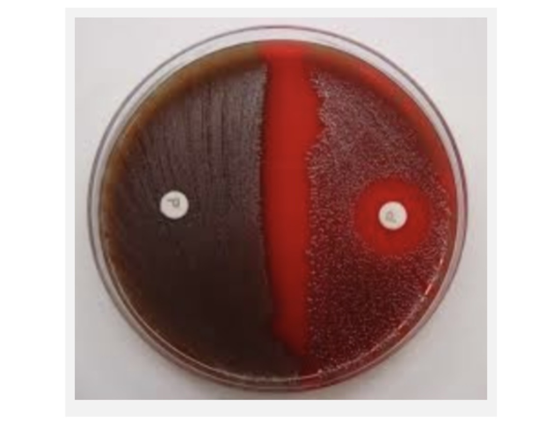 <p>The Organism that can be identified is Streptococcus pneumoniae</p><p>A. What media is used for inoculation? </p><p>B. What Antibiotic was used? </p><p>C. Which side shows its Streptococcus pneumoniae? </p>