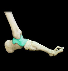 <p>Name this specific bone of the foot.</p>