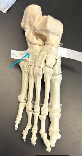 <p>ID foot region</p>
