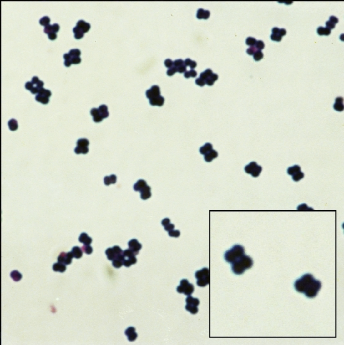 <p>GPC in pairs, tetrads, and no fermenting glucose</p>