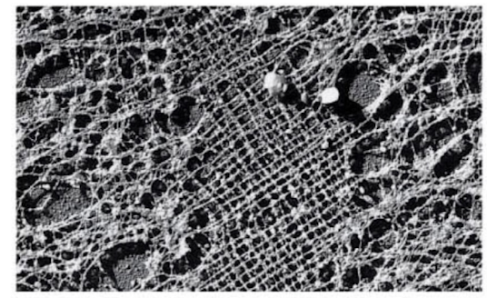 <p>what microscope was used to image this nuclear lamina?</p>