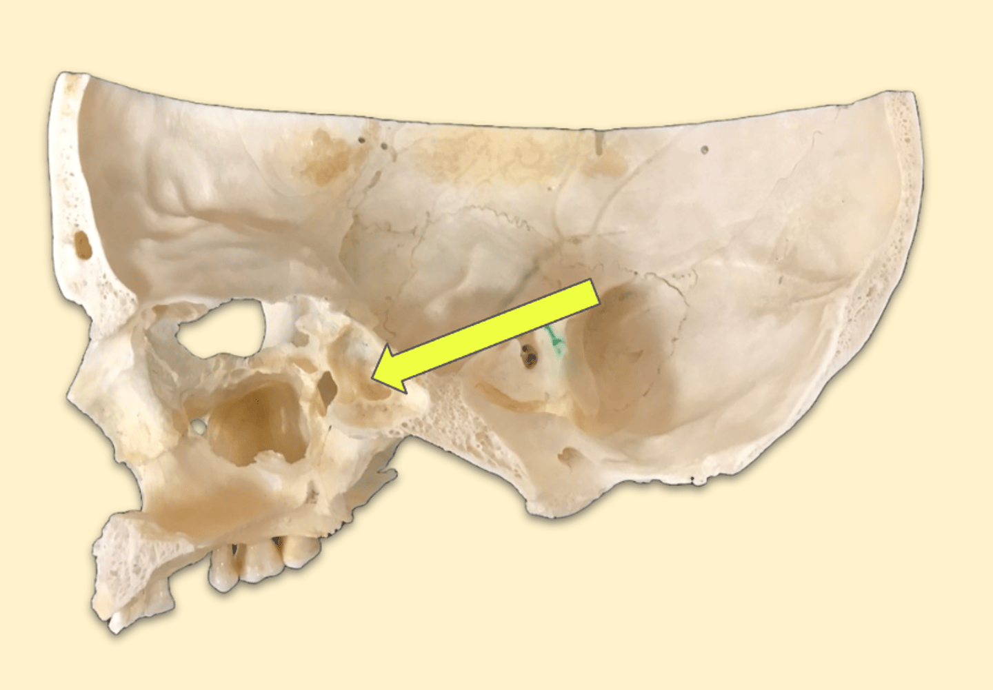 knowt flashcard image