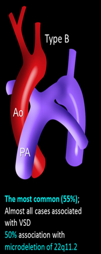 <p>between left subclavian and the LCCA </p>