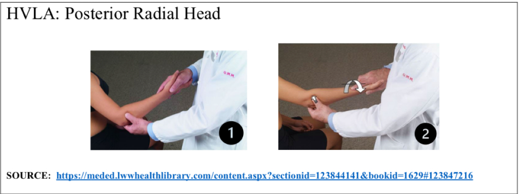 <ol><li><p>Pt seated, physician stands facing pt</p></li><li><p>Thumb on posterior aspect of radial head</p></li><li><p>Other hand holds pt hand like hand shake</p></li><li><p>Supinate forearm into barrier</p></li><li><p>Extend forearm into barrier</p></li><li><p>Thrust into extension</p></li></ol><p></p>