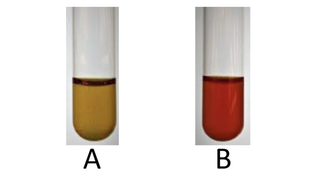 <p>Voges-Proskauer Test</p><p>a) Medium?</p><p>b) Substrate?</p><p>c) Enzyme?</p><p>d) Indicator/Reagent?</p><p>e) End Product?</p>