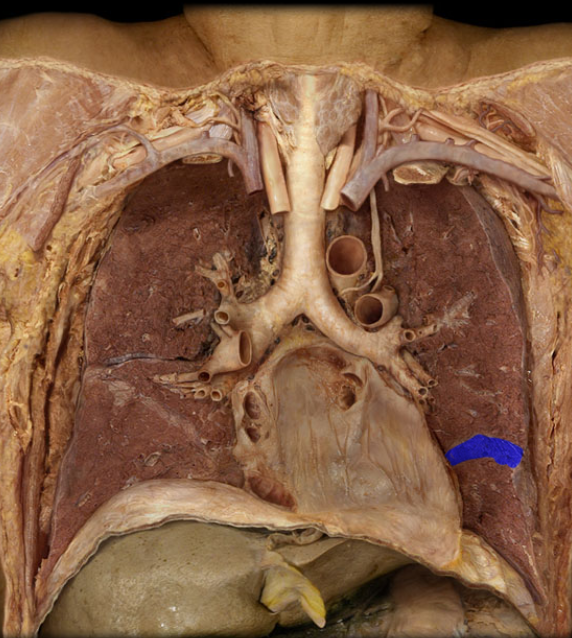 <p>Oblique Fissure of Lung</p>