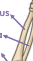<p>What bone is this?</p>