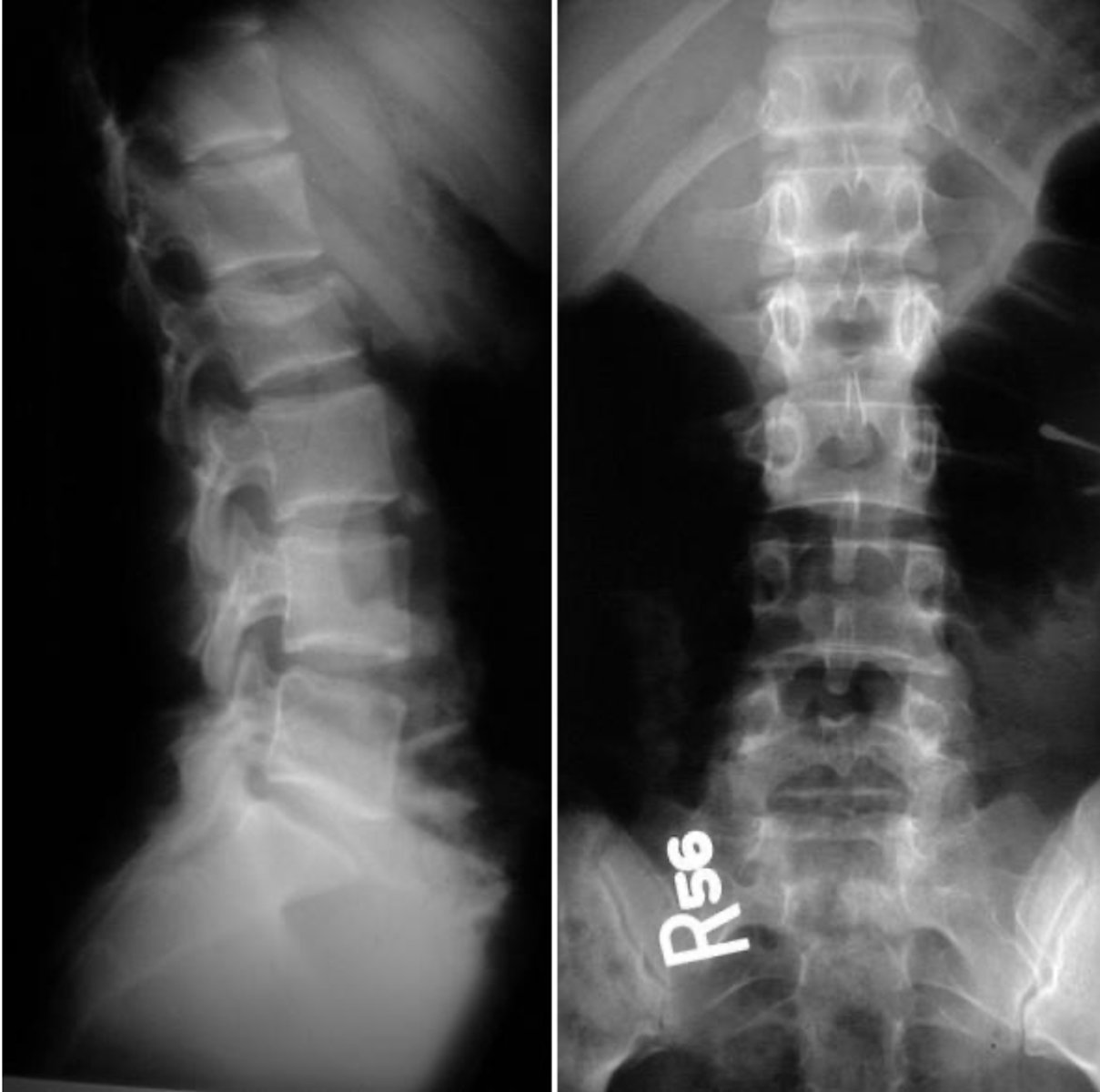 <p>What are the findings &amp; diagnosis?</p>