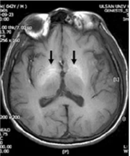 <p>Name this part of the brain</p>