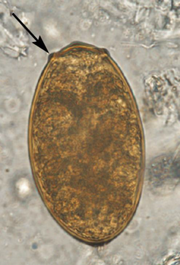 <p><em>Paragonimus</em>: Diagnosis (egg morphology)</p>