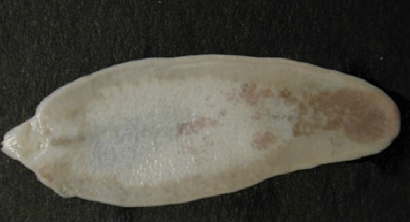 <p>What helminth/fluke/parasitic worm is this?</p>