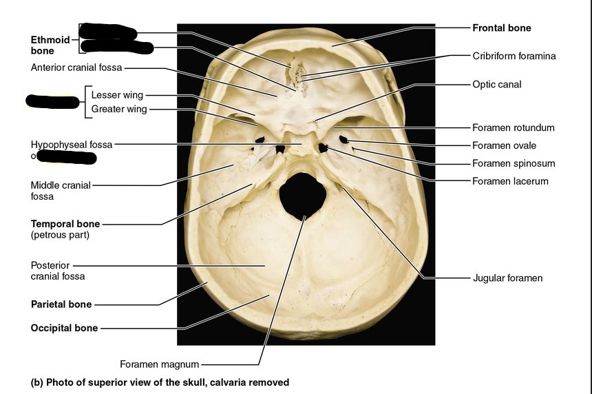 <p>Identify bone and landmark.</p>