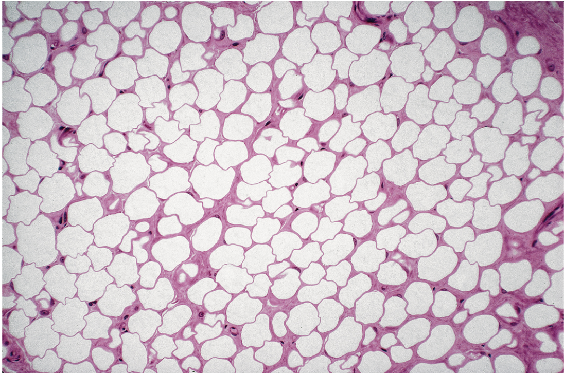 <p>Large empty looking white cells, fat cells, nucleus is pushed to the edge, little visible material between cells, each cell is called an adipocyte. </p>