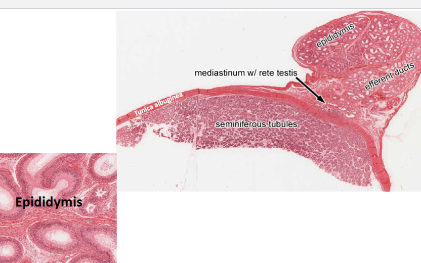 <p>Contains <strong>seminiferous tubules</strong></p><p>Cells: Leydig cells : secrete testosterone</p><ul><li><p>in stroma surrounding individual tubules</p></li><li><p>Lining: stratified seminiferous epithelium</p></li><li><p>Inside: Sperm/spermatozoa</p></li><li><p>next to sperm: spermatids (small/early)</p></li><li><p>Outside(larger): spermatogonia</p></li></ul><p>Sertoli cells: Lighter stained than spermatogonia, help develop germ cells.</p>
