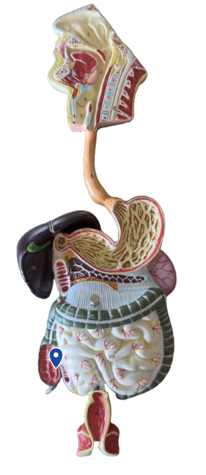 <p>Name this opening.</p>