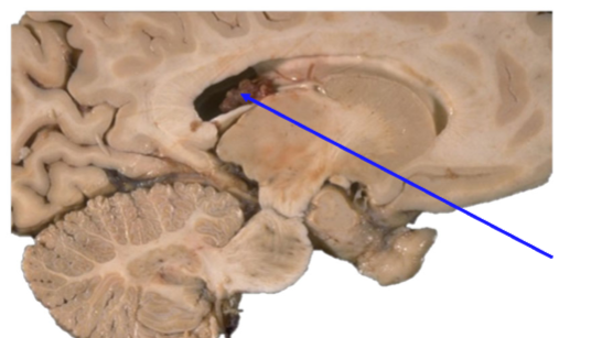 <p>Name the structure</p>