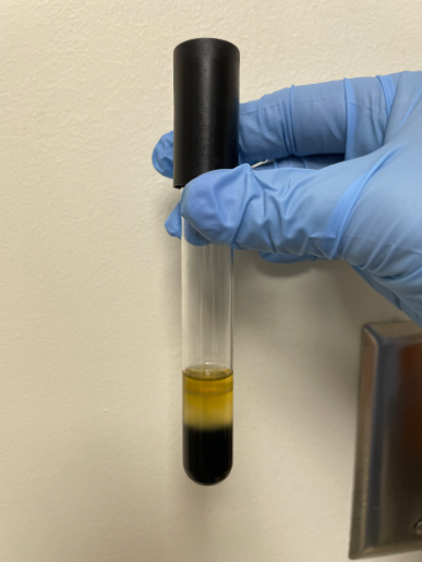 <p><span>Is the bacteria in the picture positive or negative for indole production?</span></p>