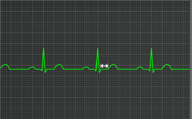 <p>What segment is this</p>