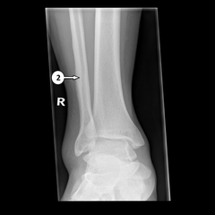<p>2?</p>