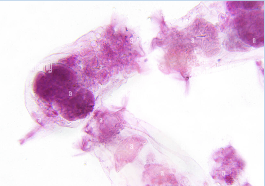 <p>The process that occurs in a certain class of all-female rotifers (part of syndermata phylum), where an egg develops into an offspring without fertilization </p><p>Advantages: no need to find a mate for reproducting </p><p>Disadvantages: No genetic outcrossing, no genetic variety </p>
