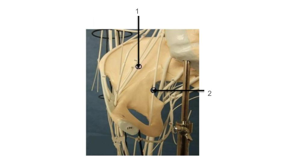 <p>1, nerve</p>